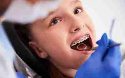 Todo lo que debes saber sobre los brakets de zafiro